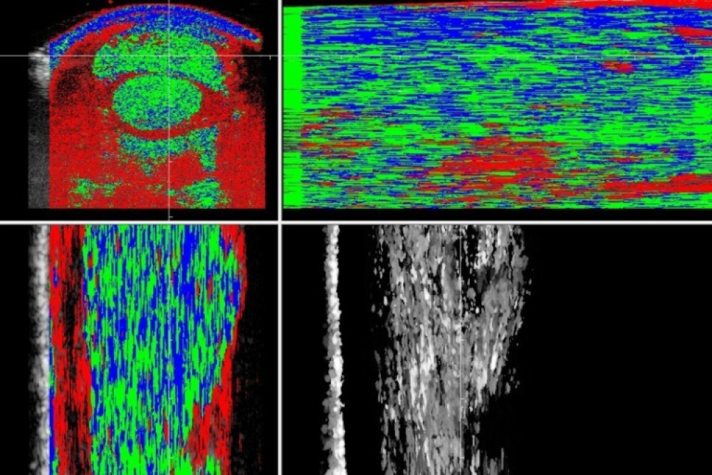 utc scan van de buigpezen