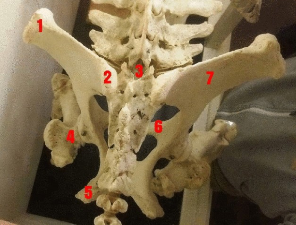 Figuur 1: Bekkenaanzicht van boven