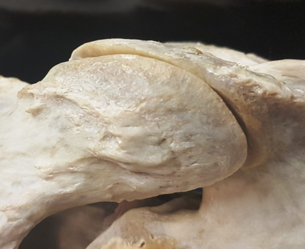 close-up van het facetgewricht